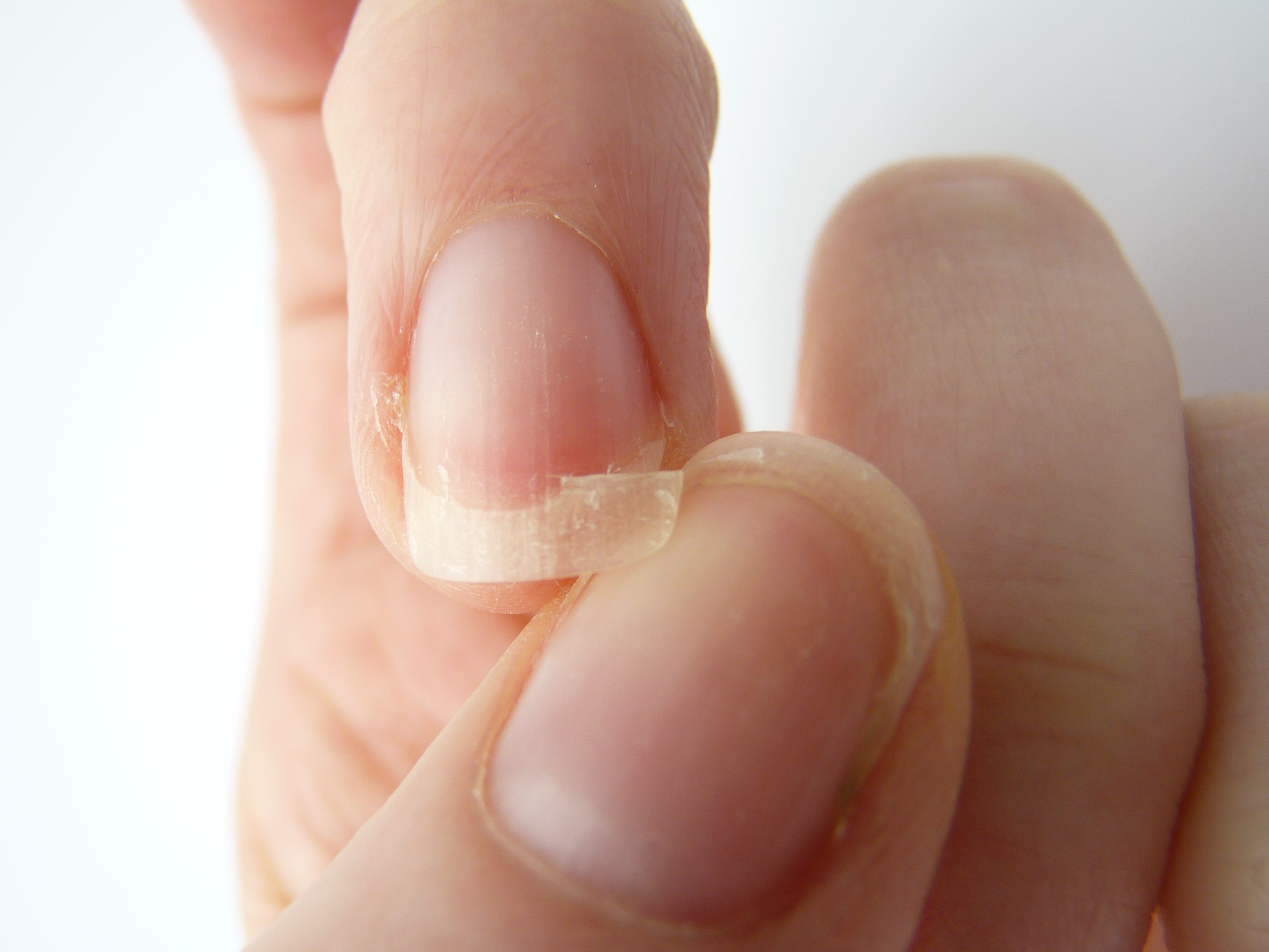 Причины ломких ногтей: секреты ухода