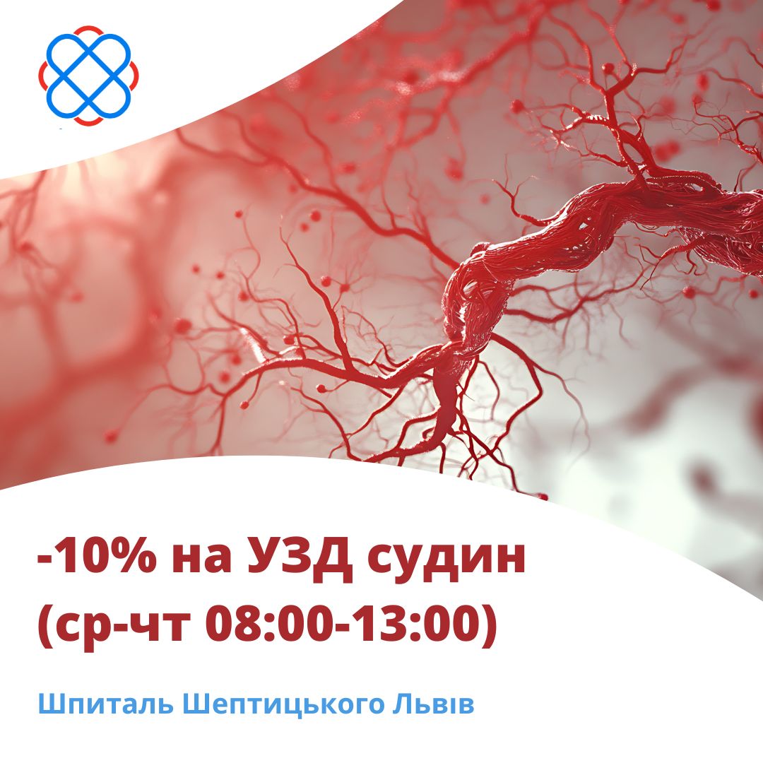 -10% на УЗД судин (ср-чт 08:00-13:00) Шпиталь Шептицького Львів