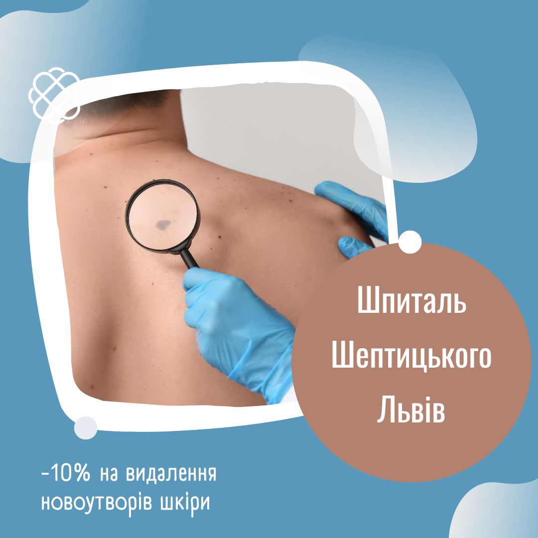 -10% на видалення новоутворів шкіри у Шпиталі Шептицького Львів