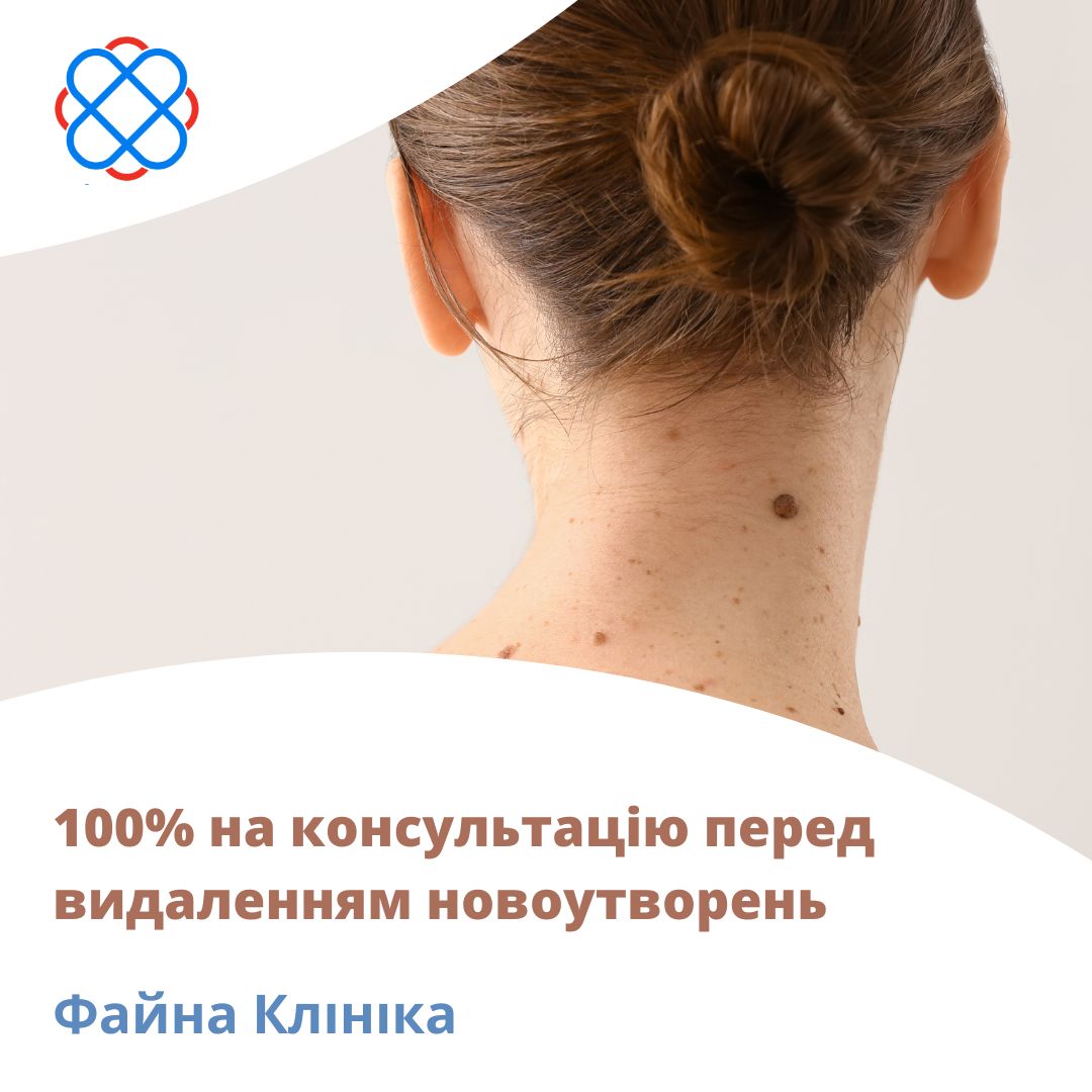 -100% на консультацію перед видаленням новоутворень в Файна Клініка