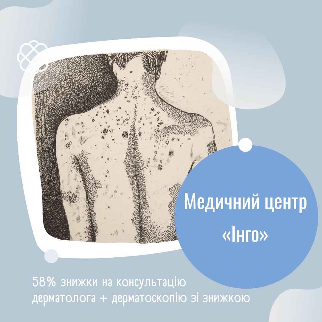 58% знижки на консультацію дерматолога + дерматоскопію зі знижкою в Медичному центрі «Інго»