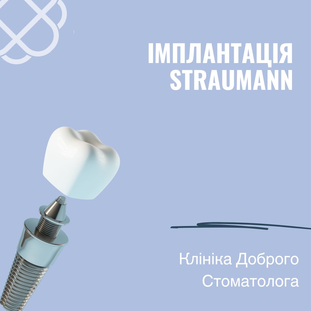 АКЦІЯ ІМПЛАНТАЦІЯ STRAUMANN в Клініці Доброго Стоматолога