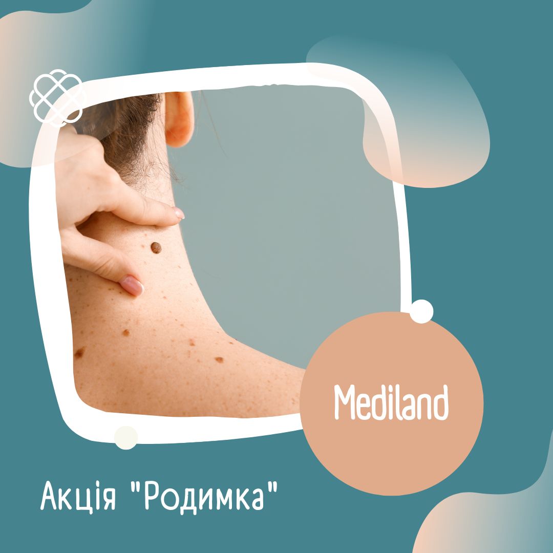 Акція "Родимка" МЦ «Mediland»