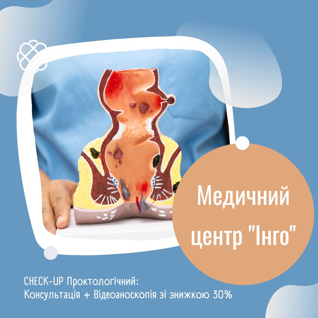 CHECK-UP Проктологічний: Консультація + Відеоаноскопія зі знижкою 30% в Медичному центрі "Інго"