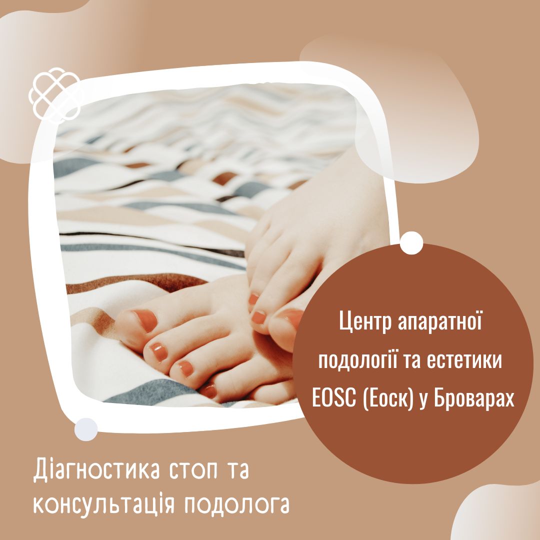 Діагностика стоп та консультація подолога в Центрі апаратної подології та естетики EOSC (Еоск) у Броварах