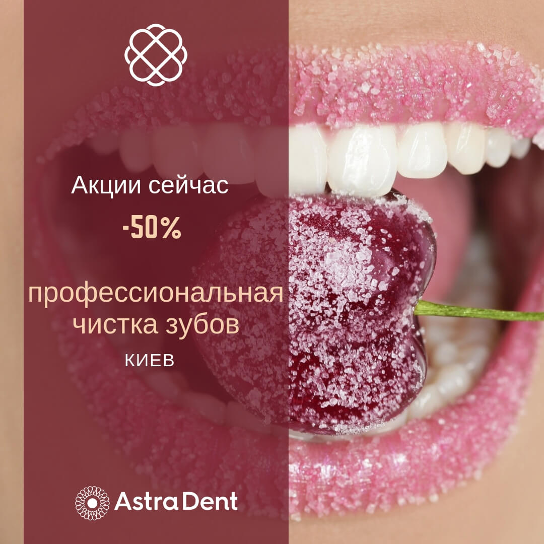 Гигиена полости рта со скидкой 50% от Astra Dent в Киеве