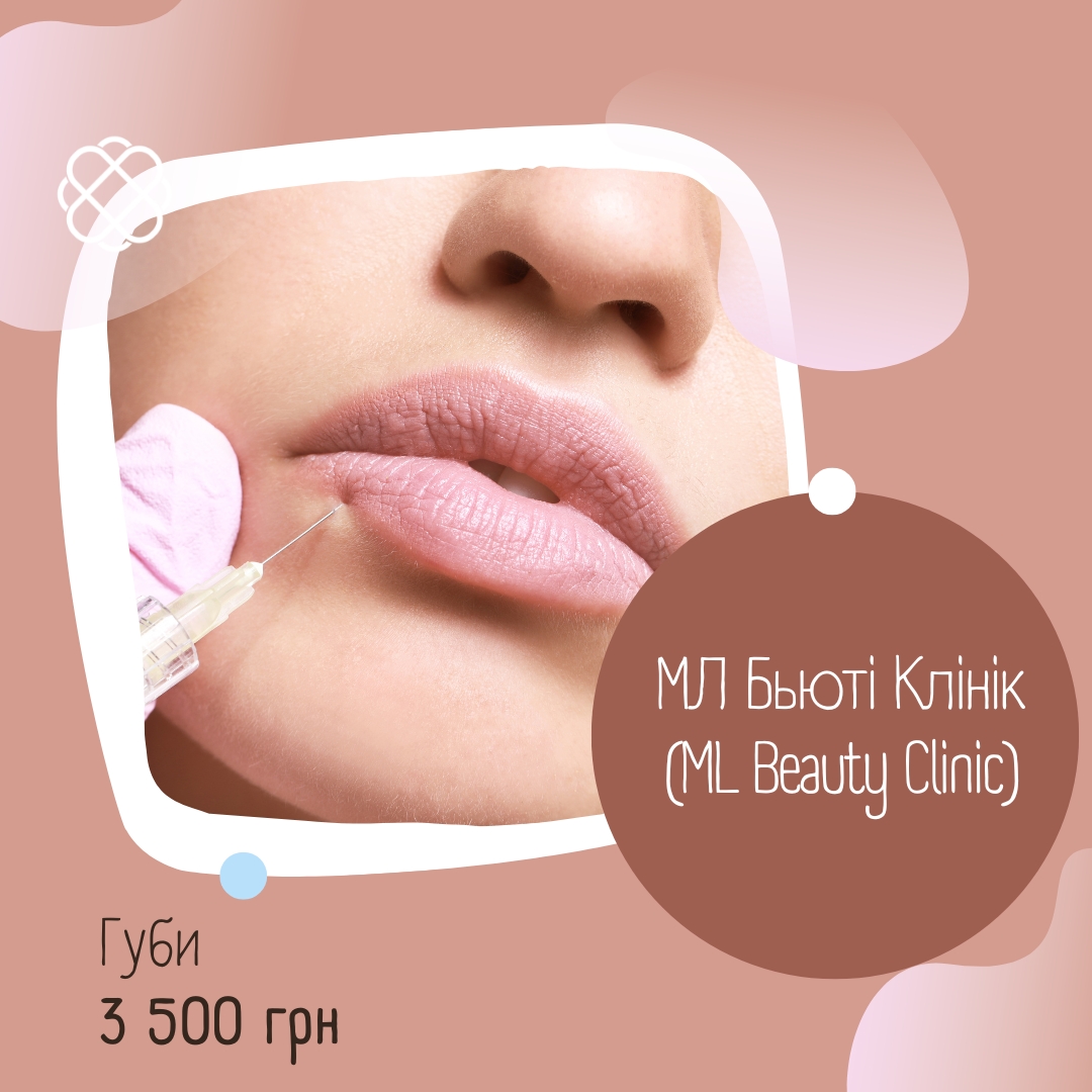 Губи в МЛ Бьюті Клінік (ML Beauty Clinic)