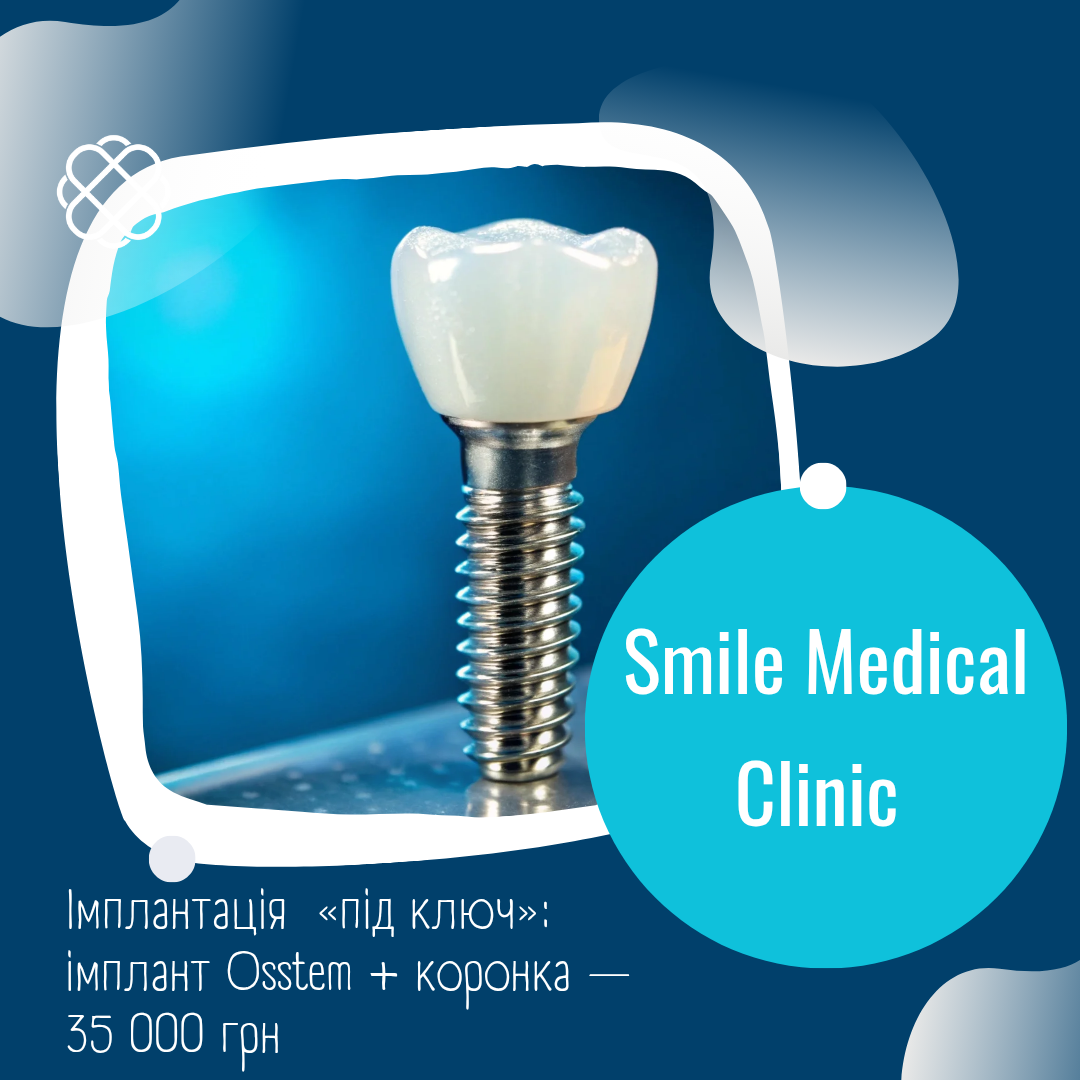 Імплантація  «під ключ»: імплант Osstem + коронка — 35 000 грн в Смайл Медікал Клінік