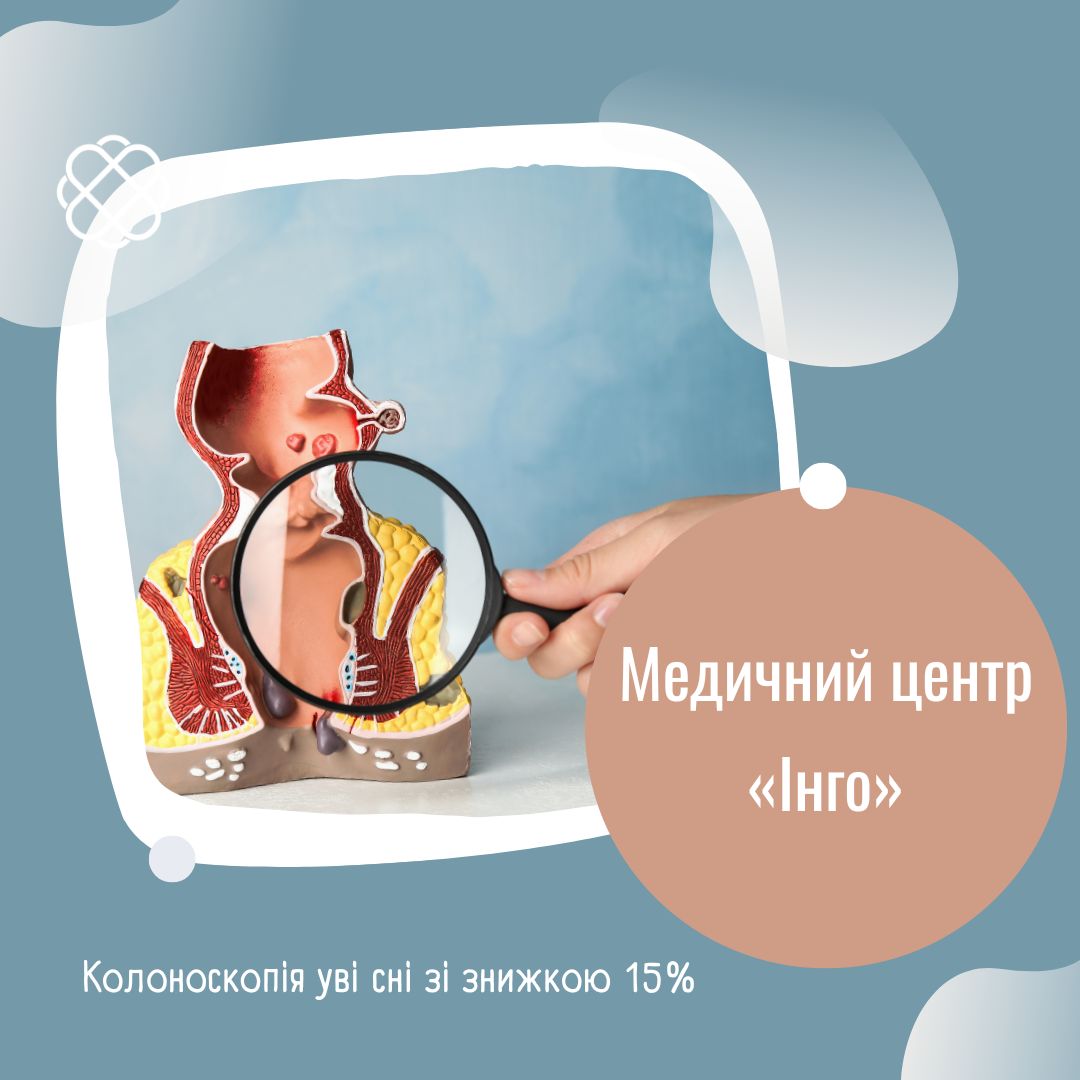 Колоноскопія уві сні зі знижкою 15% в Медичному центрі «Інго»