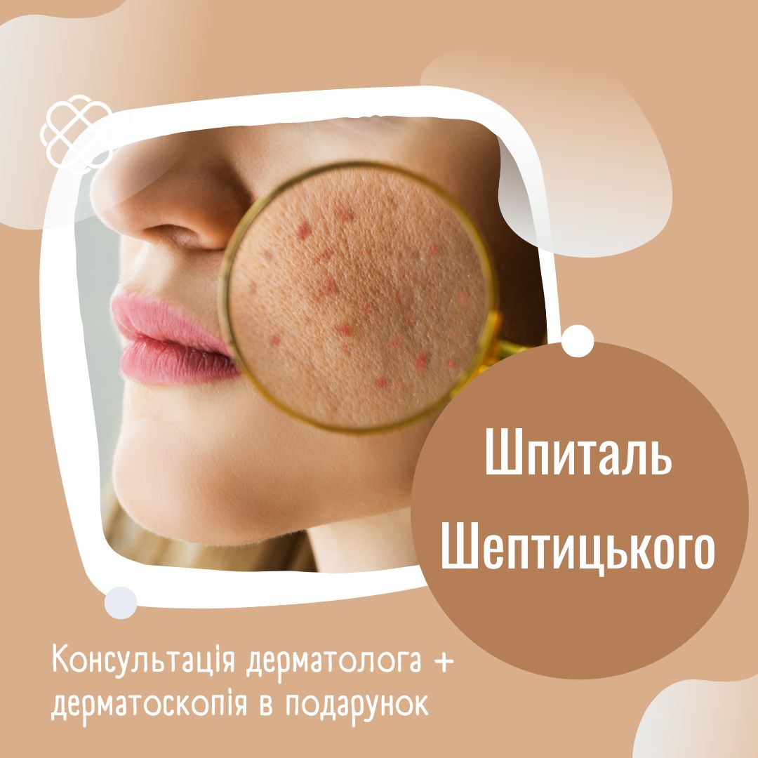 Консультація дерматолога + дерматоскопія в подарунок Шпиталь Шептицького Львів