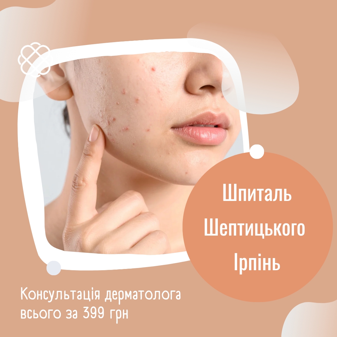 Консультація дерматолога у Шпиталі Шептицького Ірпінь