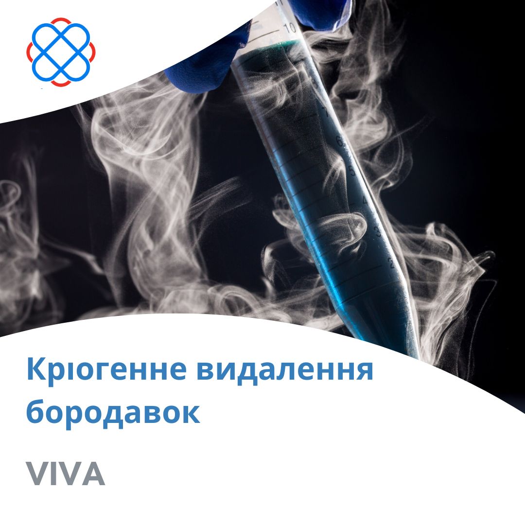 Кріогенне видалення бородавок в клініці «VIVA»