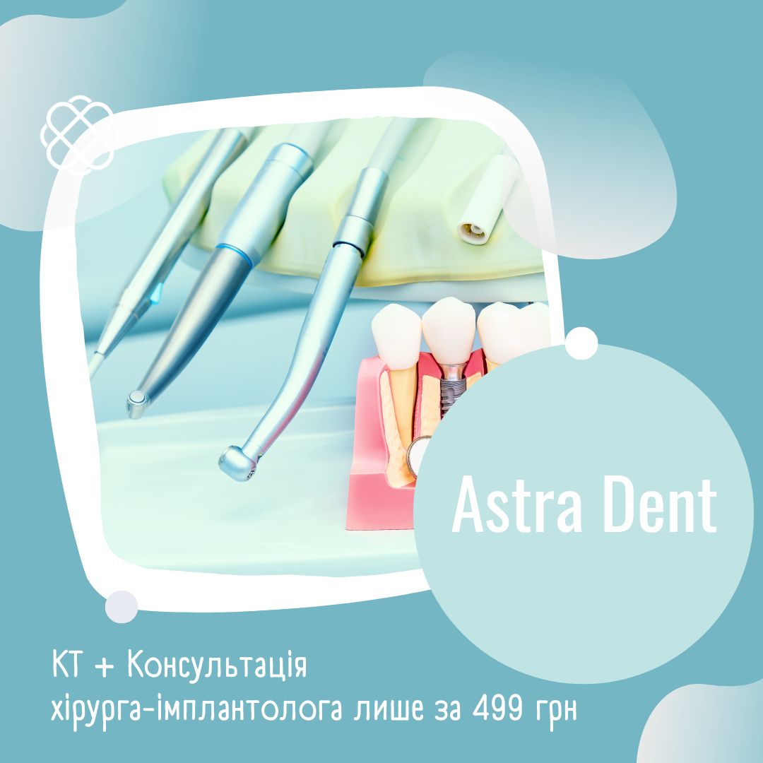 КТ + Консультація хірурга-імплантолога — лише за 499 грн