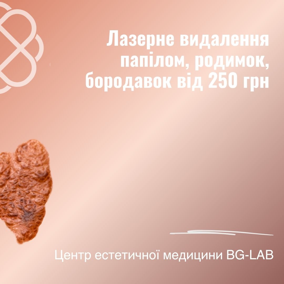Лазерне видалення папілом, родимок, бородавок від 250 грн. в Центрі естетичної медицини BG-LAB