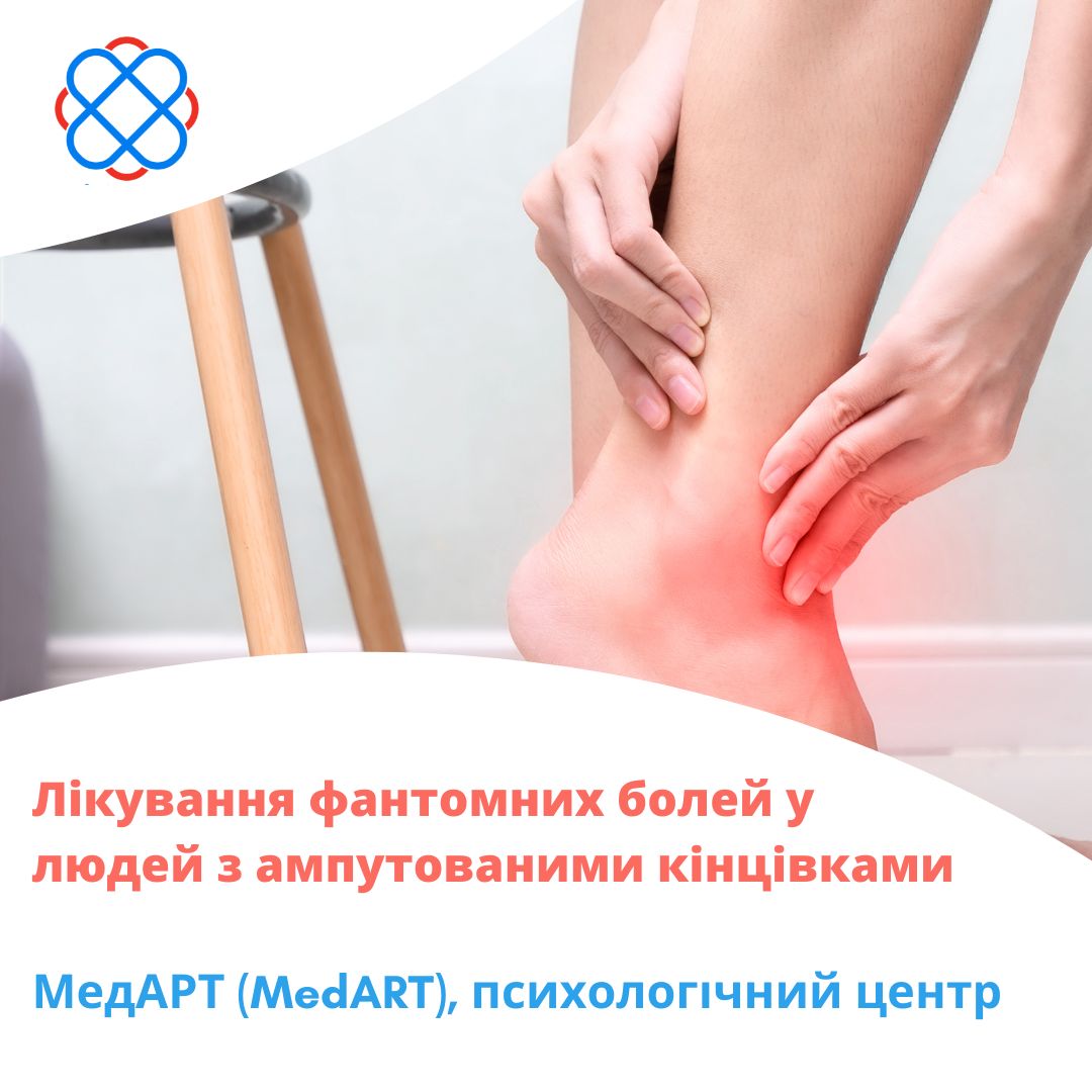 Лікування фантомних болей у людей з ампутованими кінцівками