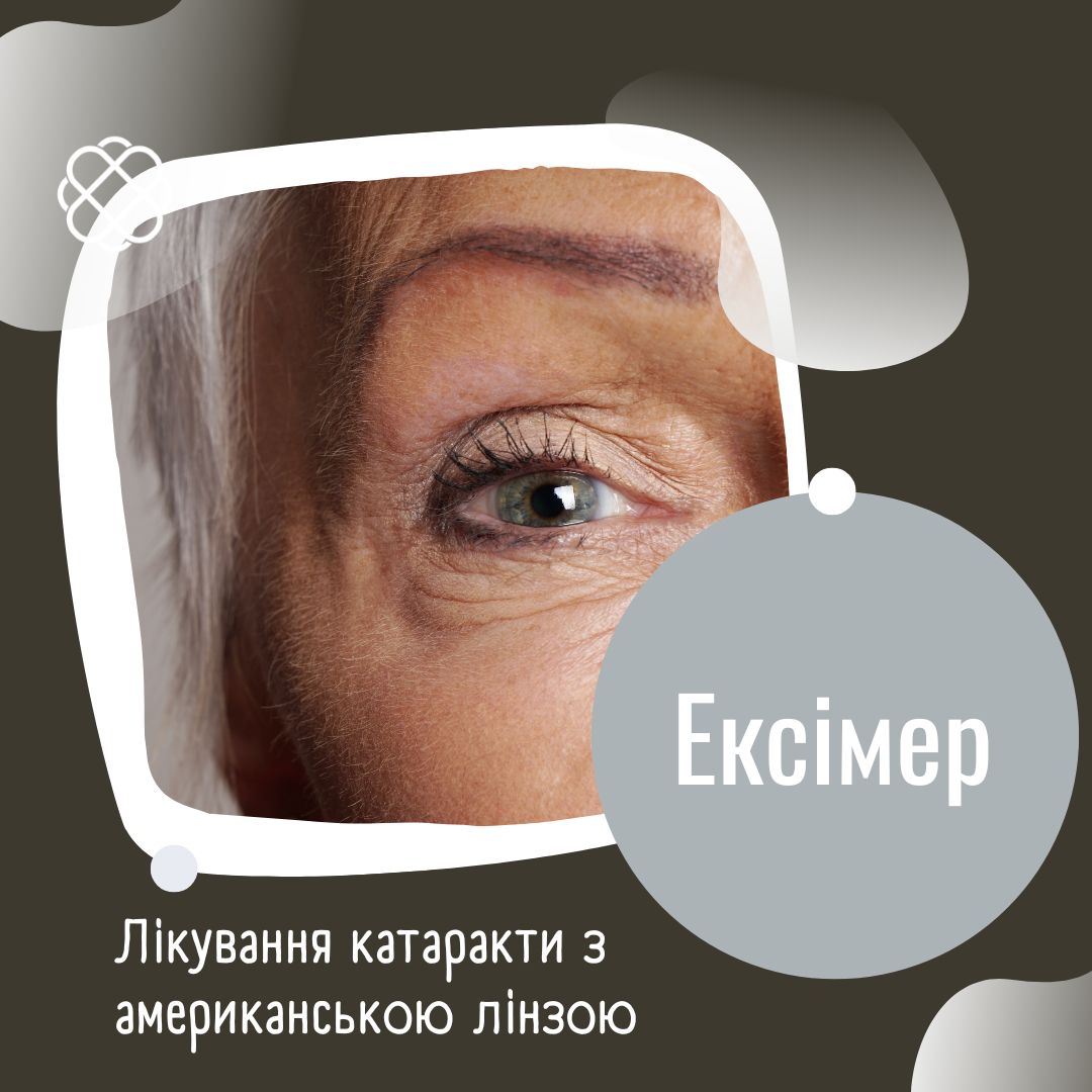 Лікування катаракти з американською лінзою в Ексімер