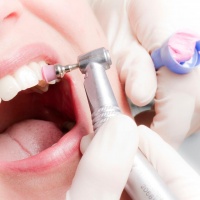 Комплексна гігієна зубів зі знижкою 50% в Viva