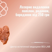 Лазерне видалення папілом, родимок, бородавок від 250 грн. в Центрі естетичної медицини BG-LAB	