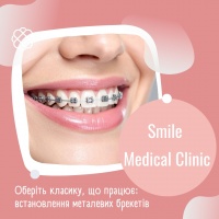 Оберіть класику, що працює: встановлення металевих брекетів — 38000 грн в Смайл Медікал Клінік!