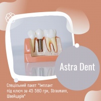 Спецільний пакет "Імплант під ключ за 45 580 грн, Straumann, Швейцарія"