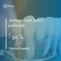 Знижка 50% на імплантація зуба з роботою у клініці Джорно Дентале