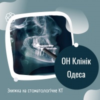 Знижка на стоматологічне КТ в ОН Клінік Одеса Стоматологія!
