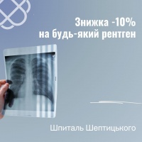 Знижка -10% на будь-який рентген у Шпиталі Шептицького
