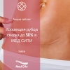 Коррекция рубца скидка до 50% в МЕД СИТИ