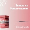 Знижка 30% на брекет-системи в Giorno Dentale