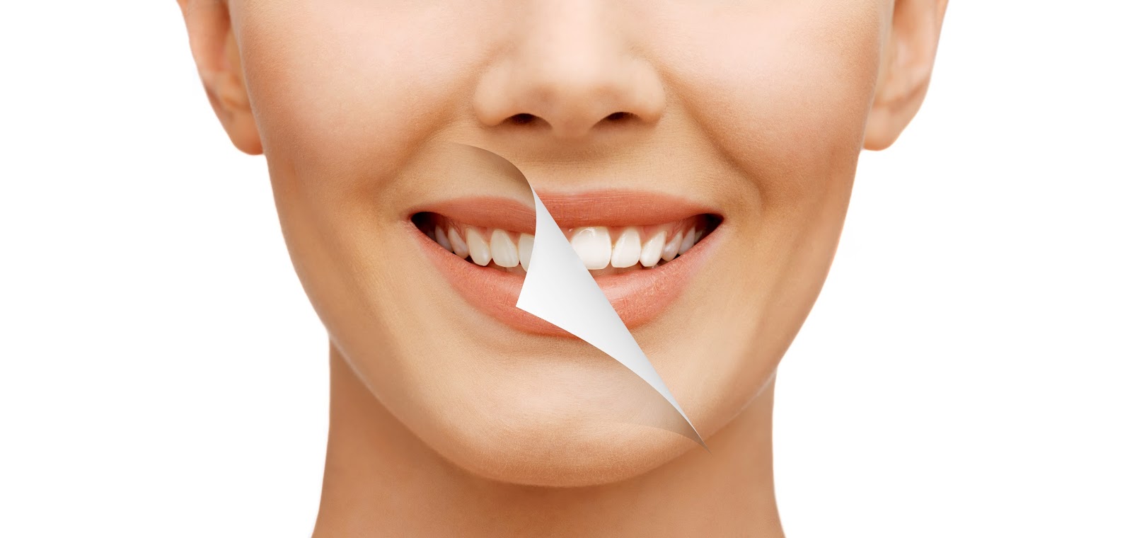Професійне відбілювання зубів зі знижкою в клініці Експерт 