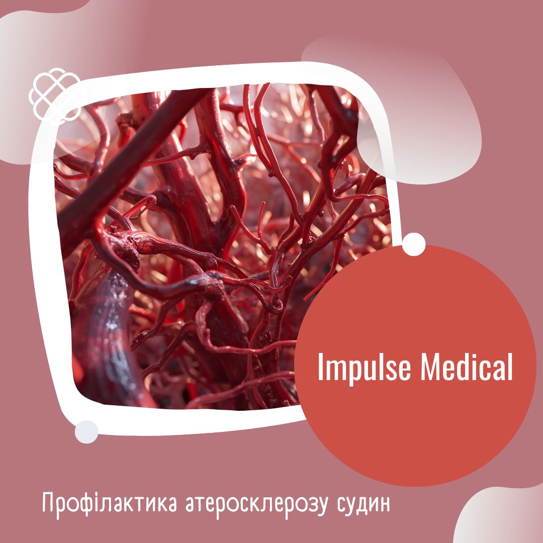 Профілактика атеросклерозу судин в Impulse Medical
