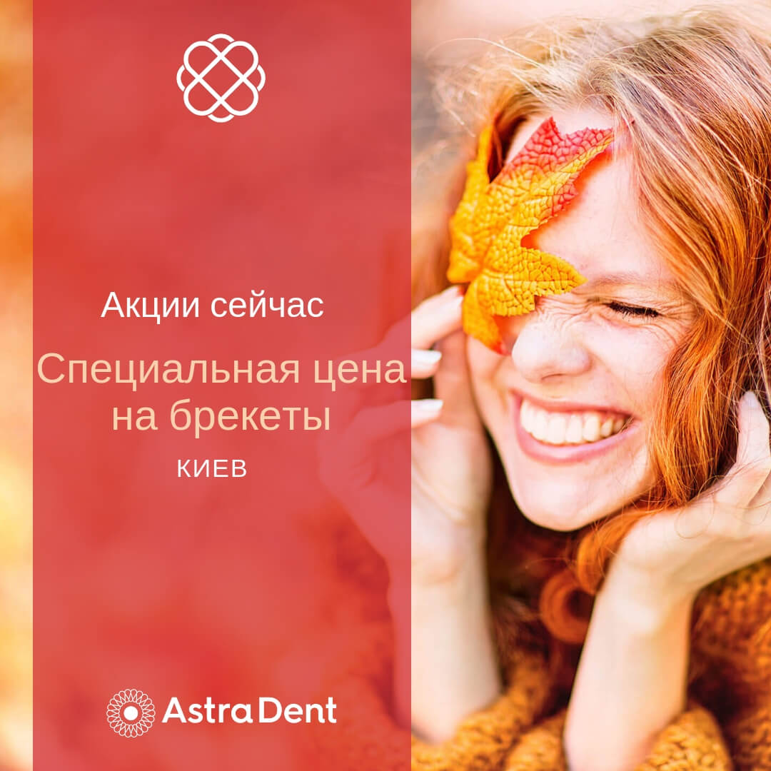 Специальная цена на брекеты в Astra Dent