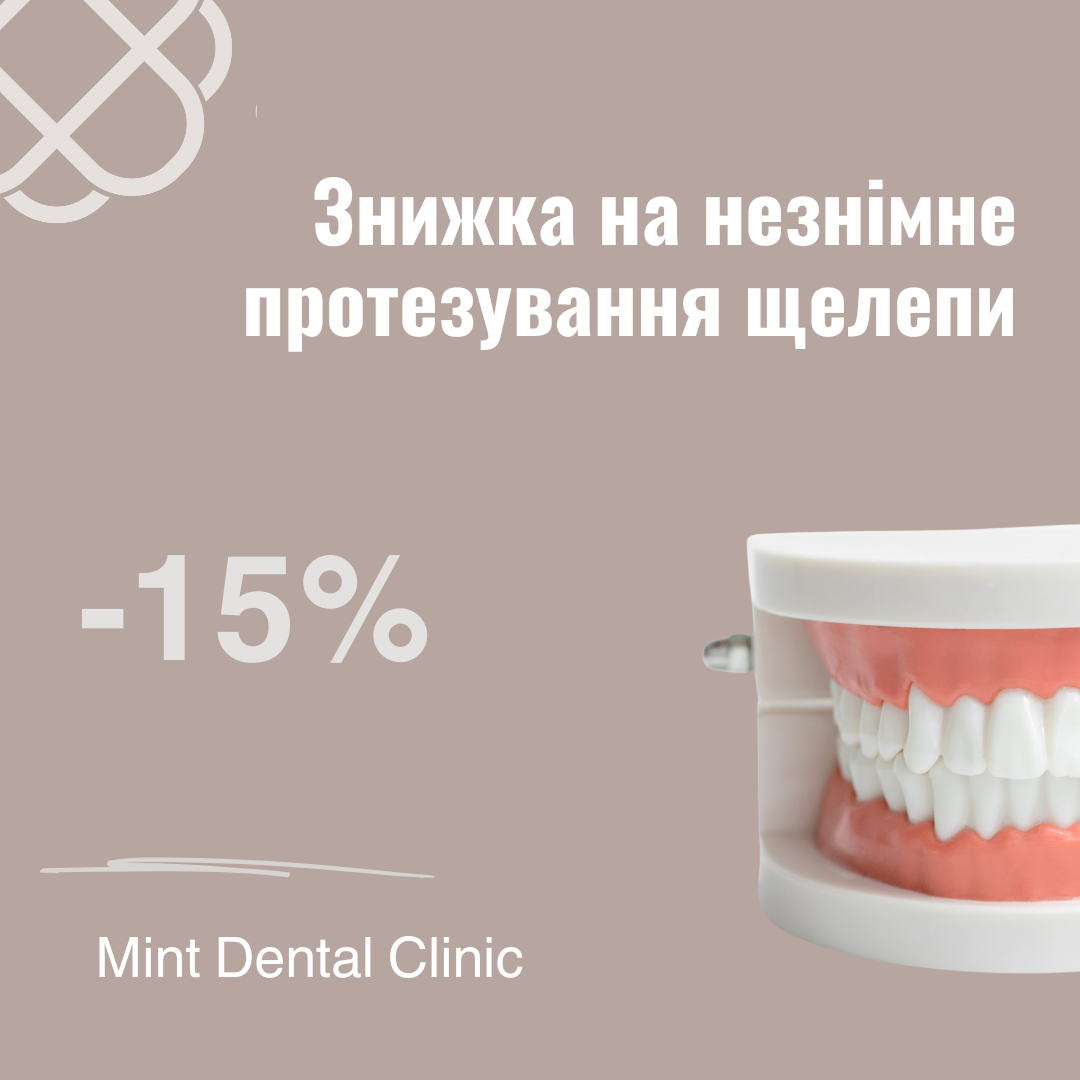 Знижка 15% на незнімне протезування щелепи!