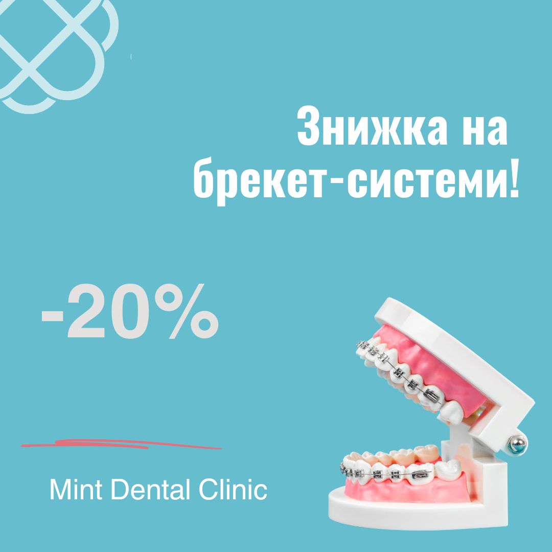 Знижка 20% на брекет-системи!