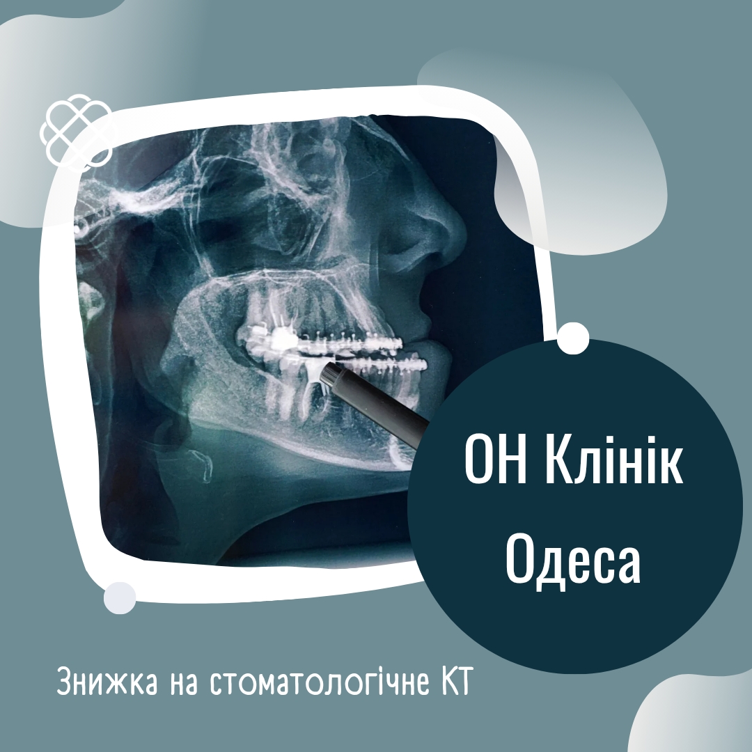 Знижка на стоматологічне КТ в ОН Клінік Одеса Стоматологія!