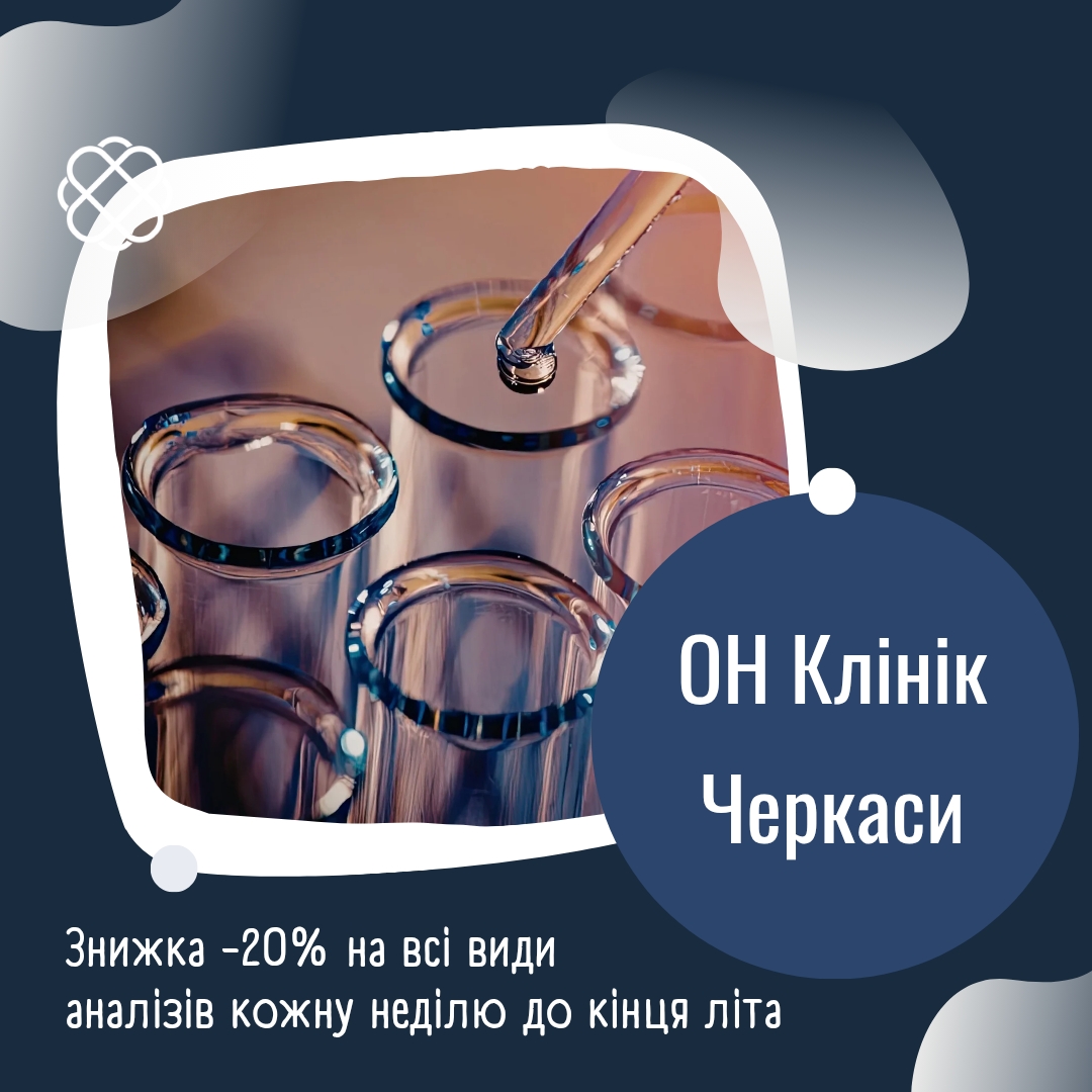 Знижка -20% на всі види аналізів кожну неділю до кінця літа в ОН Клінік Черкаси