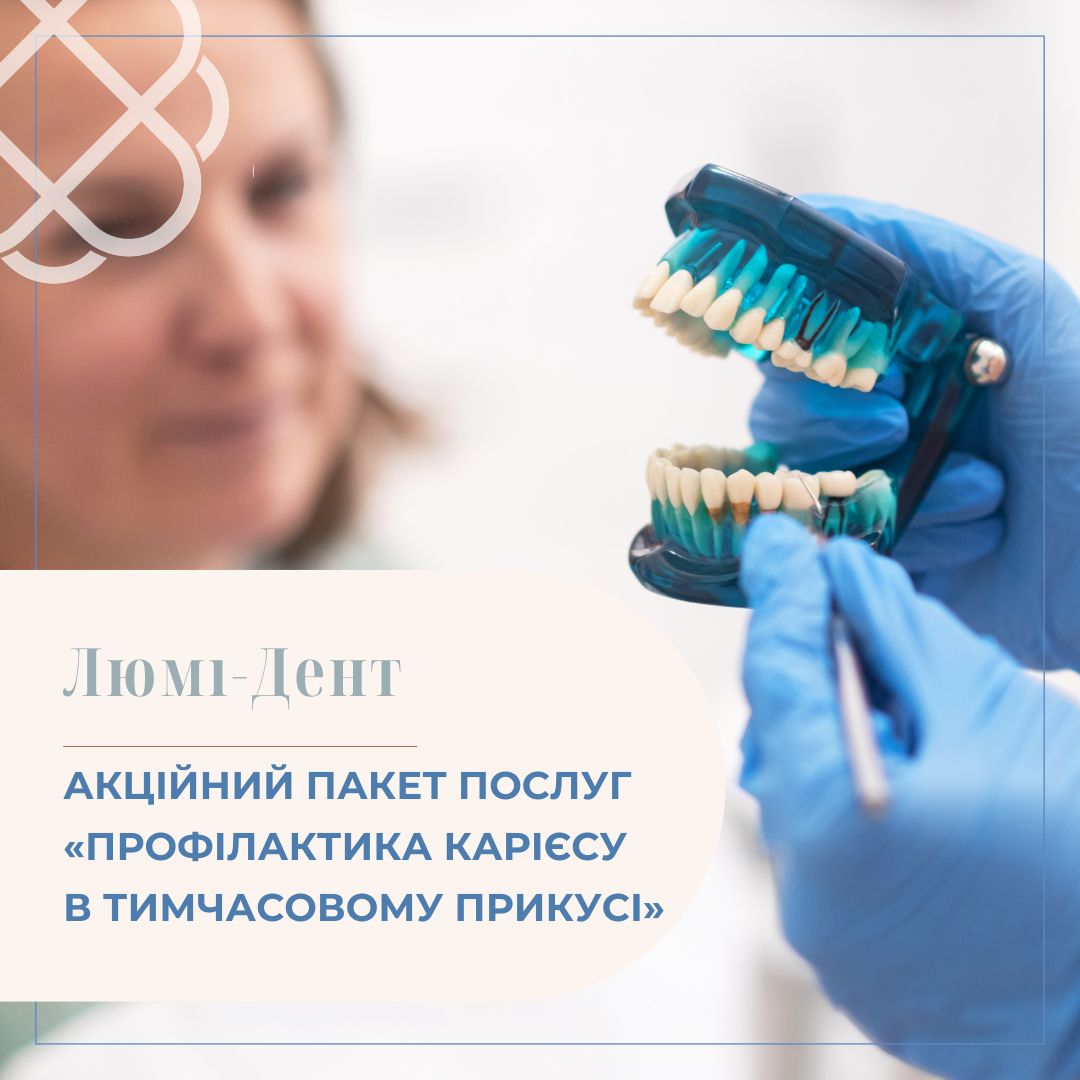 АКЦІЙНИЙ ПАКЕТ ПОСЛУГ «ПРОФІЛАКТИКА КАРІЄСУ В ТИМЧАСОВОМУ ПРИКУСІ» в мережі клінік Люмі-Дент