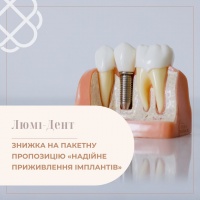 ЗНИЖКА НА ПАКЕТНУ ПРОПОЗИЦІЮ «НАДІЙНЕ ПРИЖИВЛЕННЯ ІМПЛАНТІВ» в мережі клінік Люмі-Дент