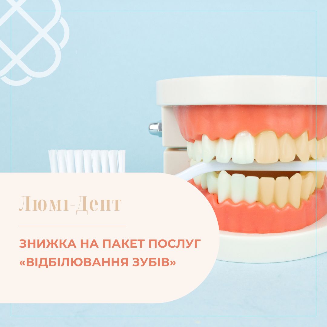 ЗНИЖКА НА ПАКЕТ ПОСЛУГ «ВІДБІЛЮВАННЯ ЗУБІВ» в мережі клінік Люмі-Дент