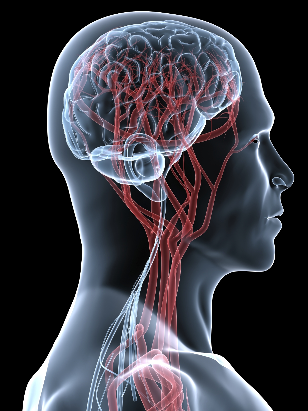 Основные методы и показания к обследованию сосудов головного мозга