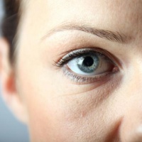 Как избавиться от синяка под глазом - лечение и рекомендации