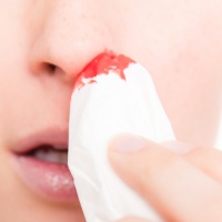 Почему из носа течет кровь?