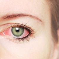 Покраснение глаз: усталость или болезнь?