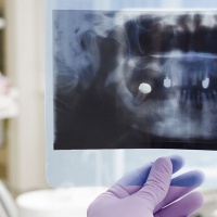Томография в стоматологии