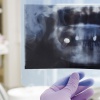 Томография в стоматологии