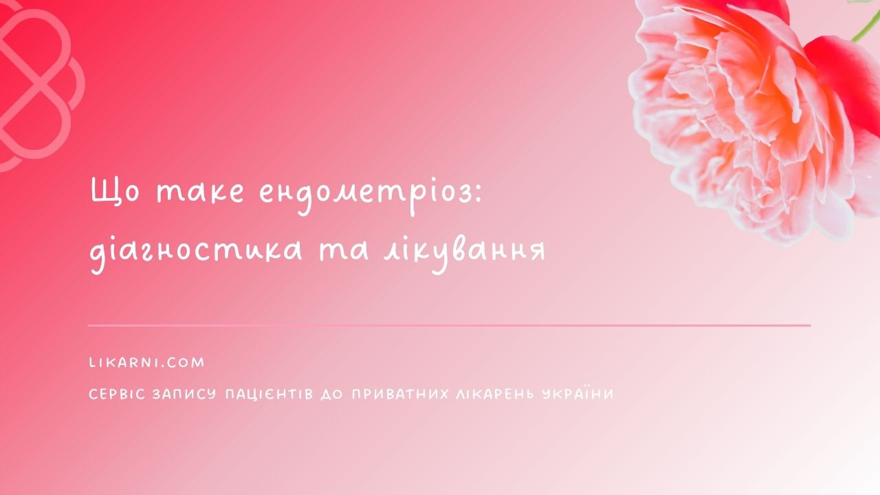 Що таке ендометріоз: діагностика та лікування