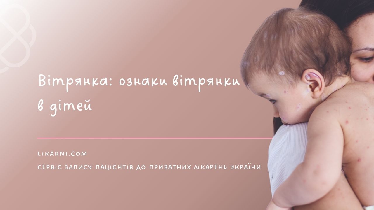 Вітрянка: ознаки вітрянки в дітей