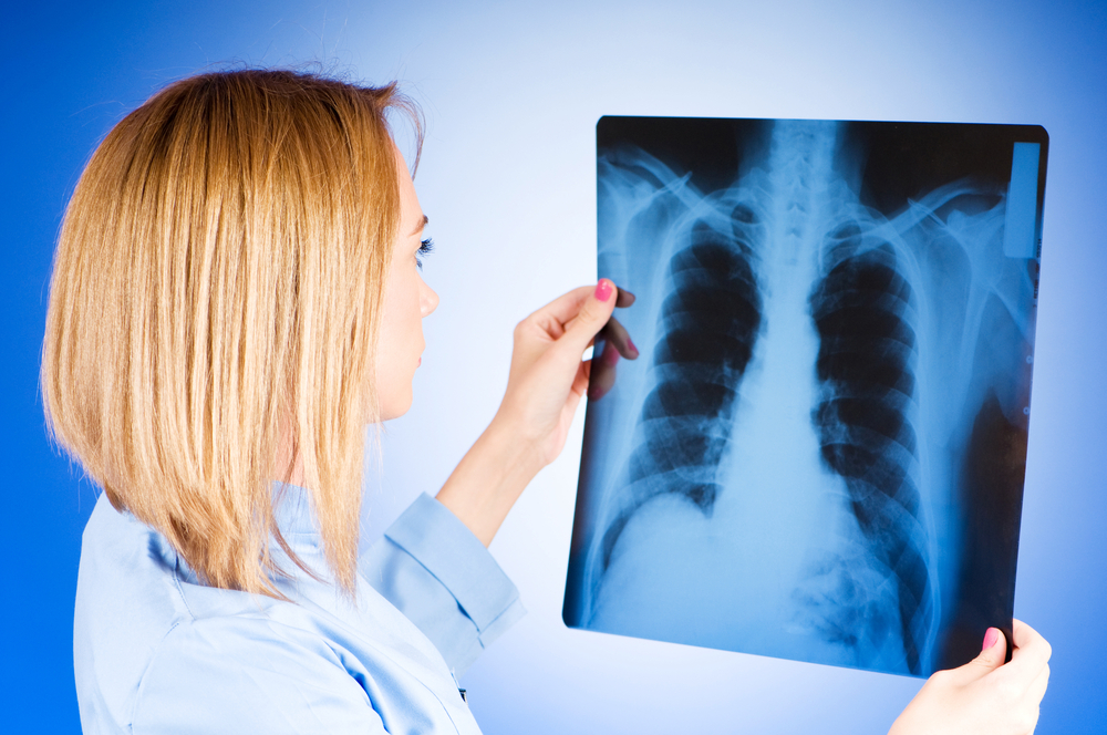 Туберкулез: симптомы и лечение