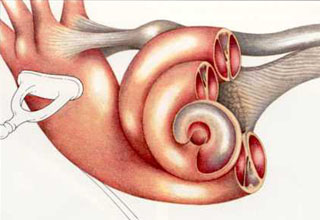 Воспаление внутреннего уха