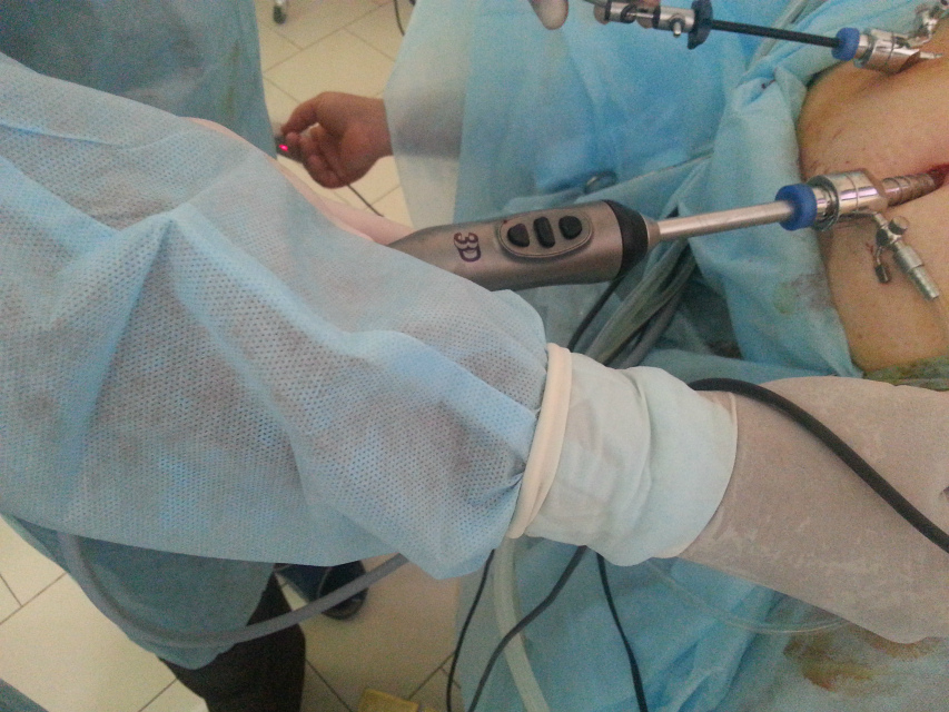 В медцентре "Ибн Сина+" проводят 3D-операции